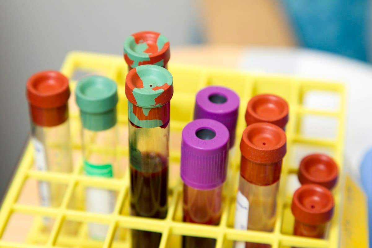 Anastrozole for Men: Uses, Side Effects and TRT Guidelines