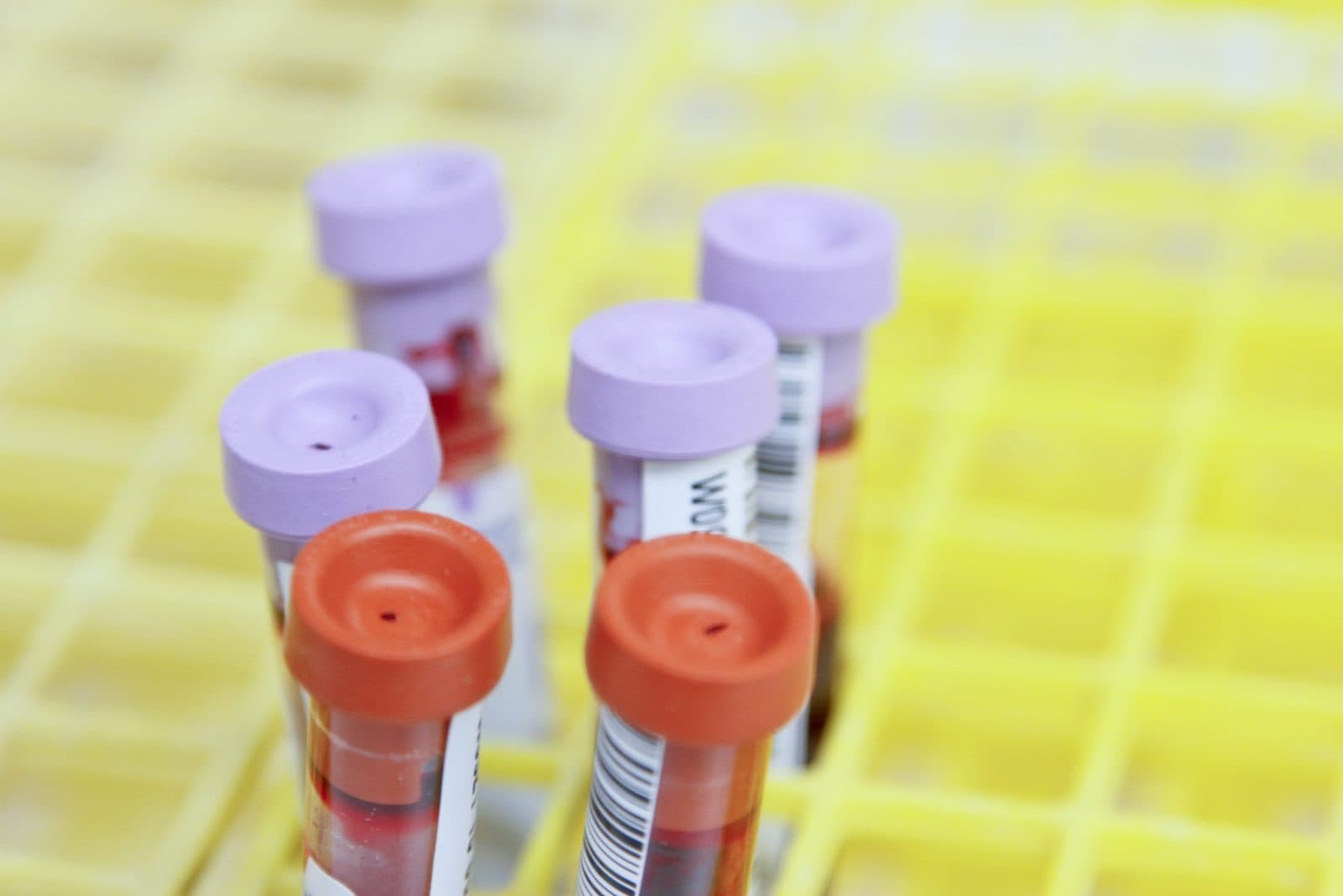 Hormone Testing for Women: Which Markers, and When in the Cycle