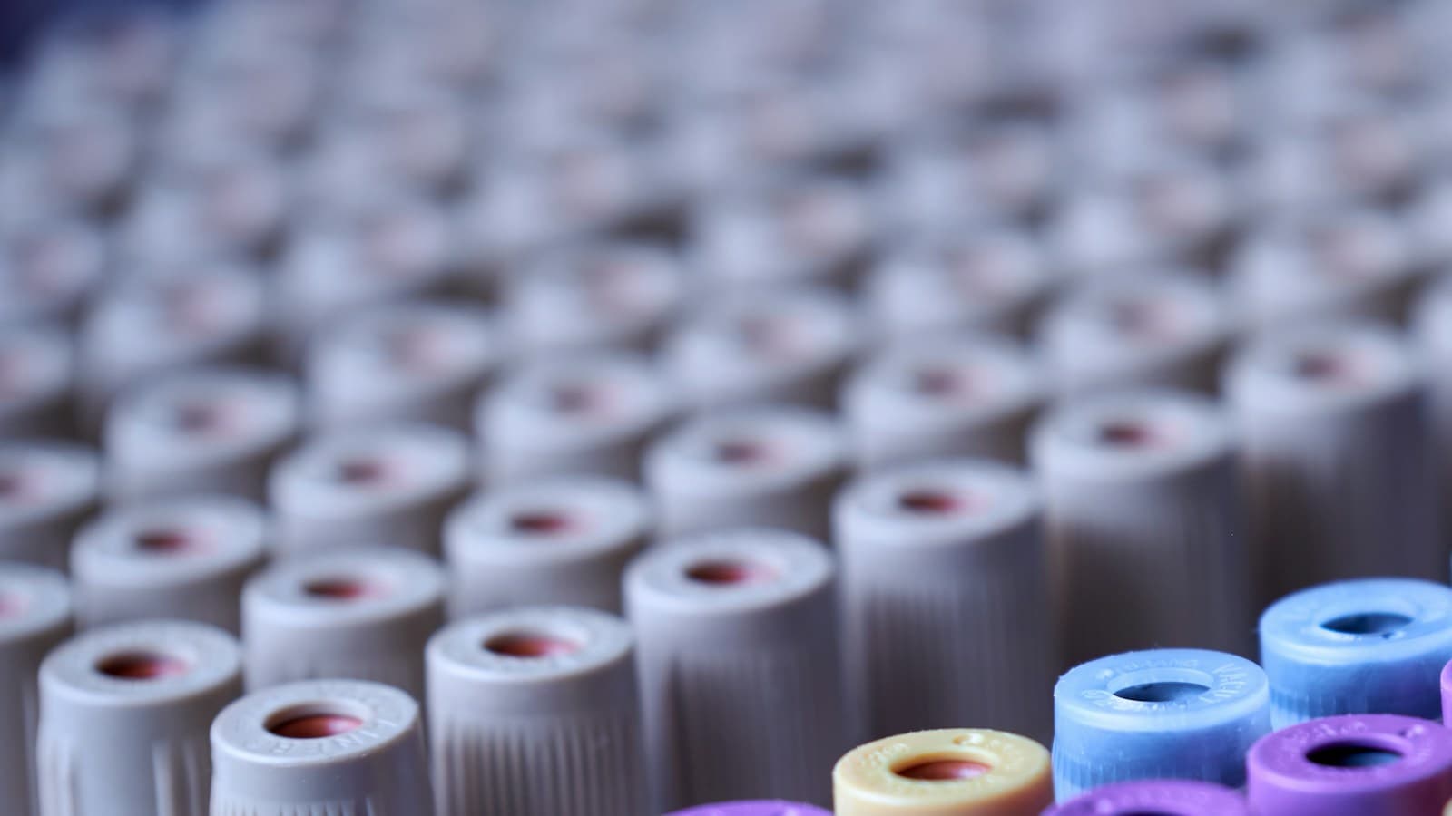 Where to Get Blood Work Done Near Me in Westchester, NY